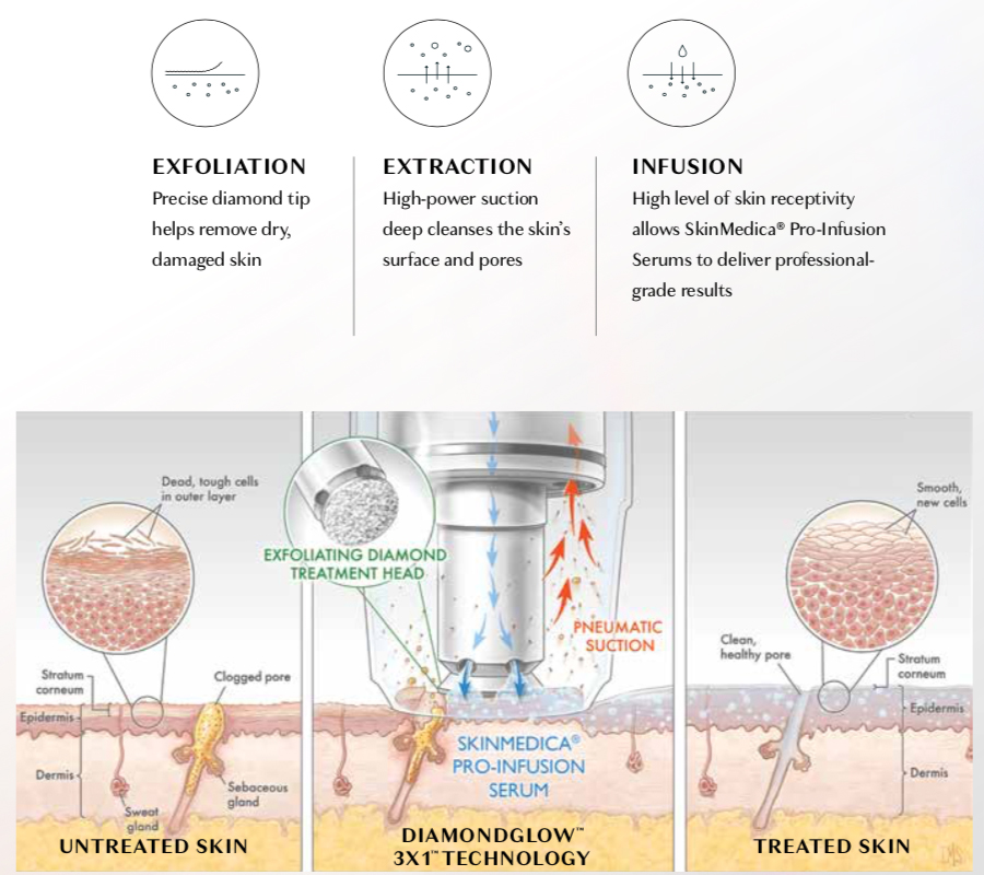 Silkpeel DermalInfusion