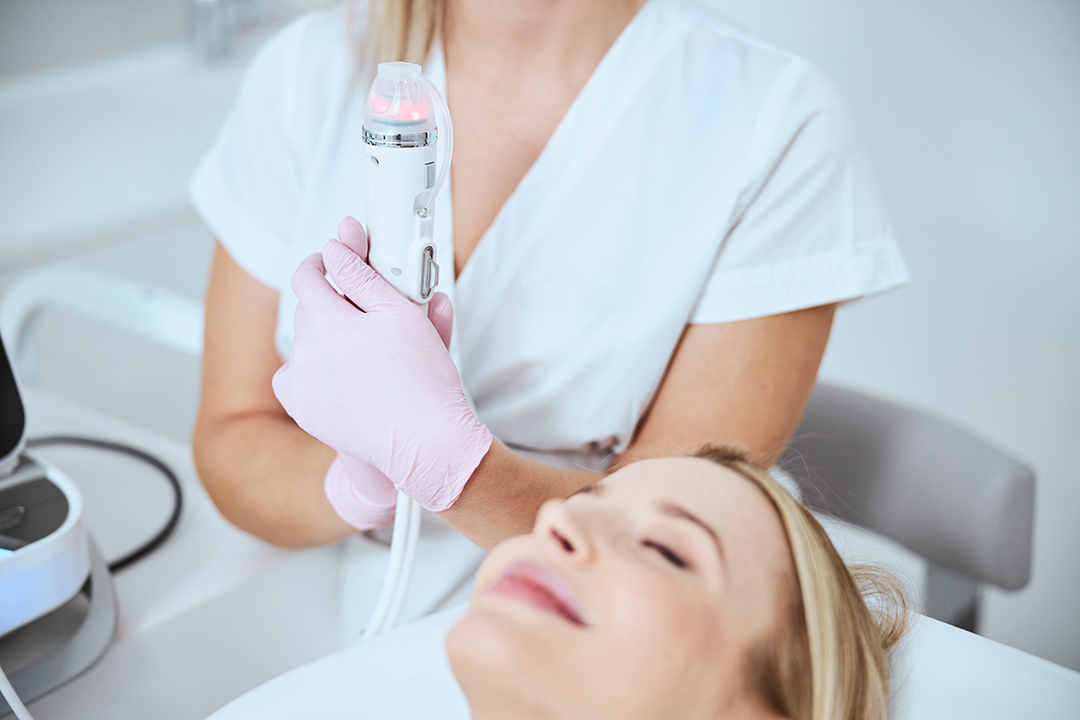 microneedling